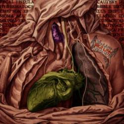 Fetus Slicer : Demo 2015